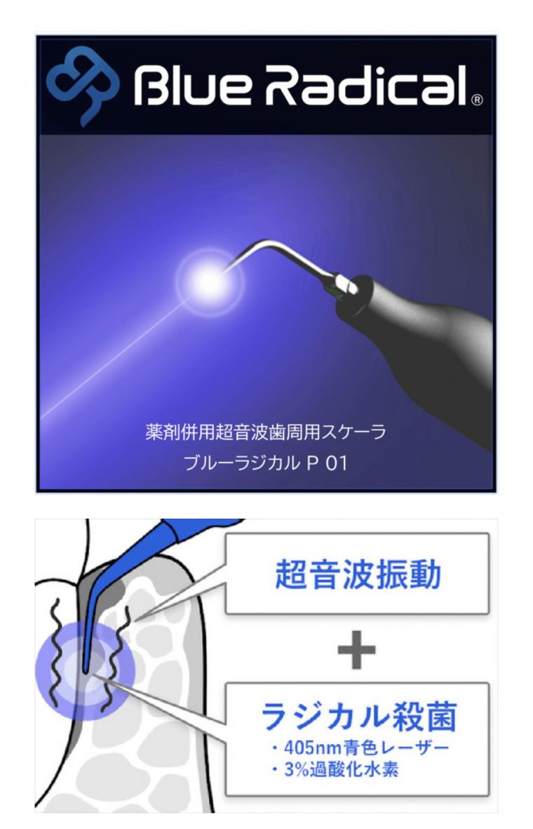 〜歯周病と喫煙(タバコ)の関係〜