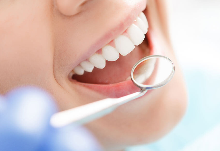 歯周病管理や虫歯チェックも含んだ治療